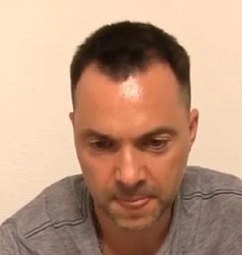 person person human face forehead