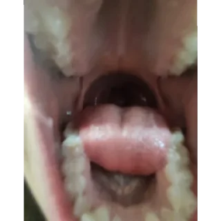Sticker рот у стоматолога будешь открывать - 10