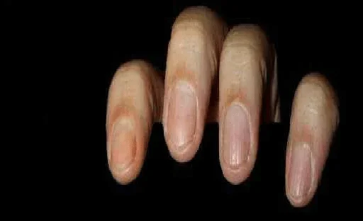 finger nail hand