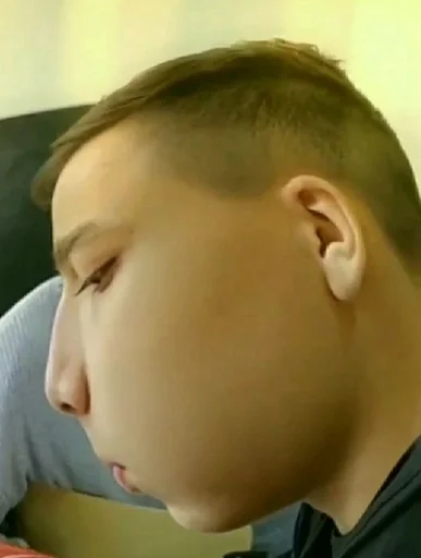 person person cheek skin